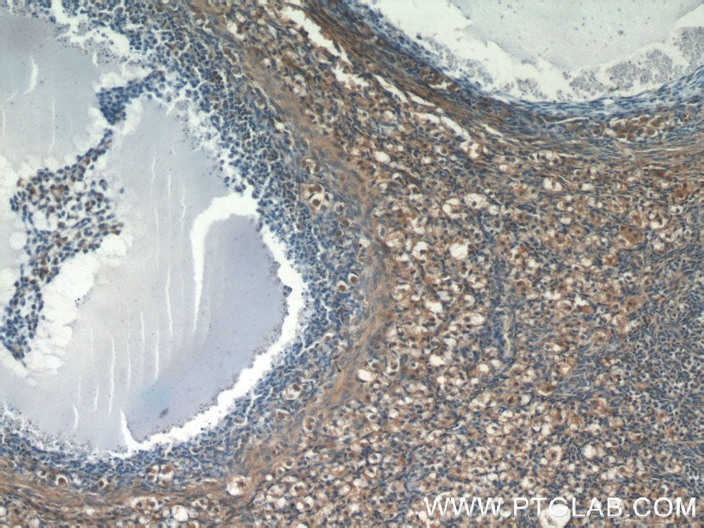 Immunohistochemistry (IHC) staining of human ovary tissue using Sodium iodide symporter Polyclonal antibody (24324-1-AP)