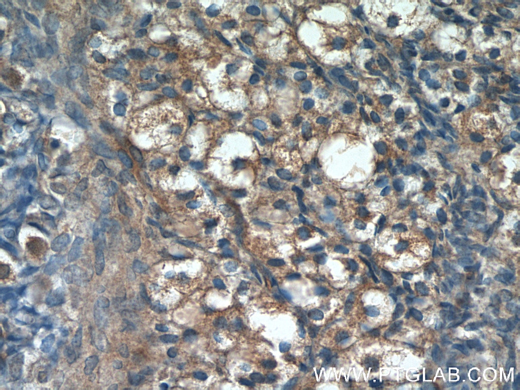 Immunohistochemistry (IHC) staining of human ovary tissue using Sodium iodide symporter Polyclonal antibody (24324-1-AP)