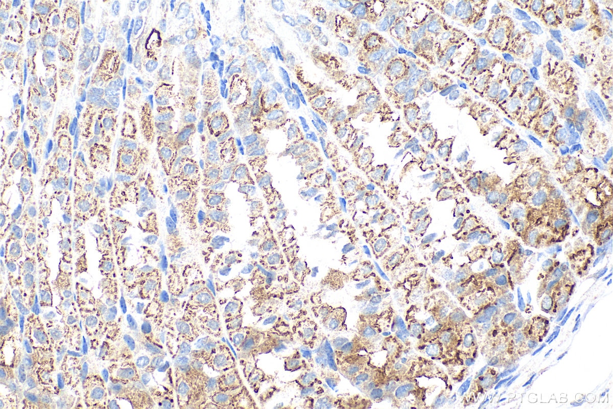 Immunohistochemical analysis of paraffin-embedded mouse stomach tissue slide using 24324-1-AP (Sodium iodide symporter antibody) at dilution of 1:1000 (under 40x lens). Heat mediated antigen retrieval with Tris-EDTA buffer (pH 9.0). Immunohistochemistry (IHC) staining of mouse stomach tissue using Sodium iodide symporter Polyclonal antibody (24324-1-AP)