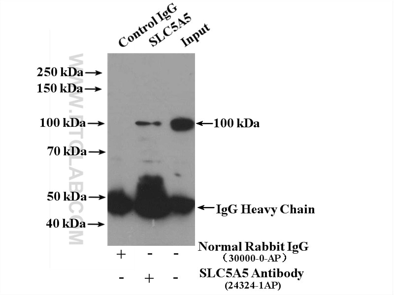 Immunoprecipitation (IP) experiment of mouse testis tissue using Sodium iodide symporter Polyclonal antibody (24324-1-AP)