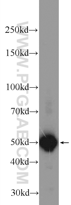 Western Blot (WB) analysis of mouse stomach tissue using Sodium iodide symporter Polyclonal antibody (24324-1-AP)