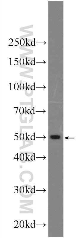 Western Blot (WB) analysis of SGC-7901 cells using Sodium iodide symporter Polyclonal antibody (24324-1-AP)