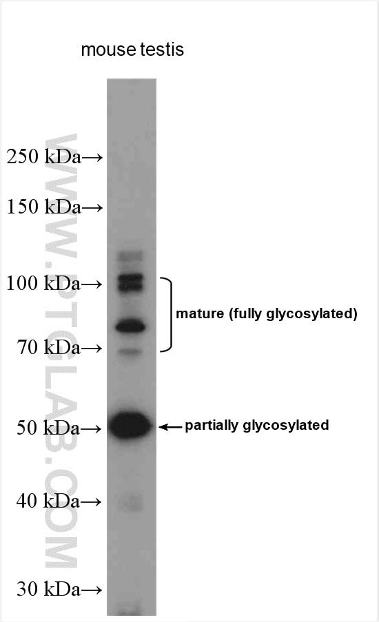 Western Blot (WB) analysis of various lysates using Sodium iodide symporter Polyclonal antibody (24324-1-AP)