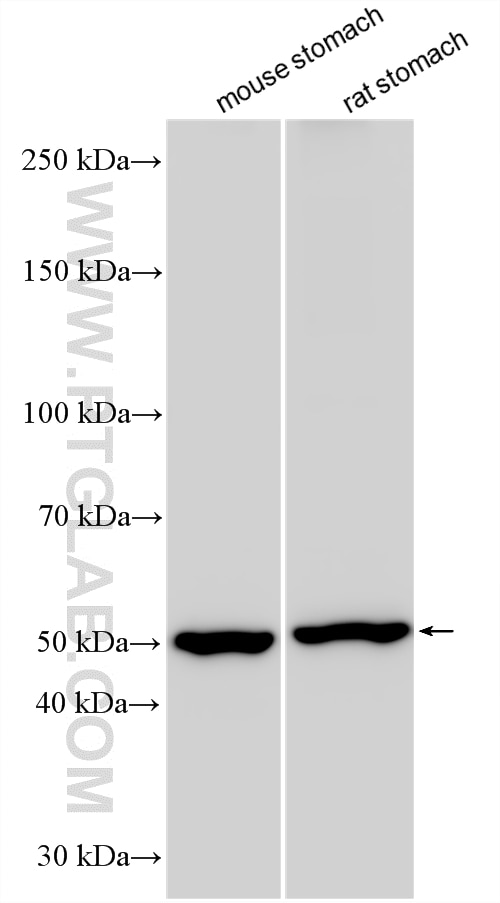 Various lysates were subjected to SDS PAGE followed by western blot with 24324-1-AP (Sodium iodide symporter antibody) at dilution of 1:5000 incubated at room temperature for 1.5 hours. Western Blot (WB) analysis of various lysates using Sodium iodide symporter Polyclonal antibody (24324-1-AP)