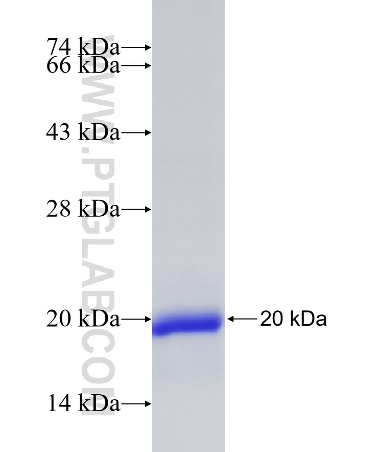 SLC5A5 fusion protein Ag19277 SDS-PAGE