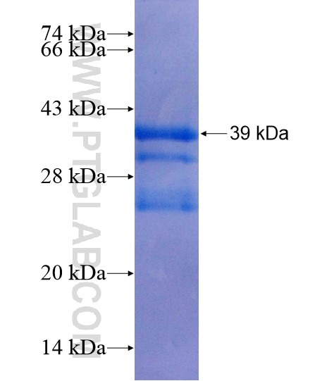 SLC5A5 fusion protein Ag19504 SDS-PAGE