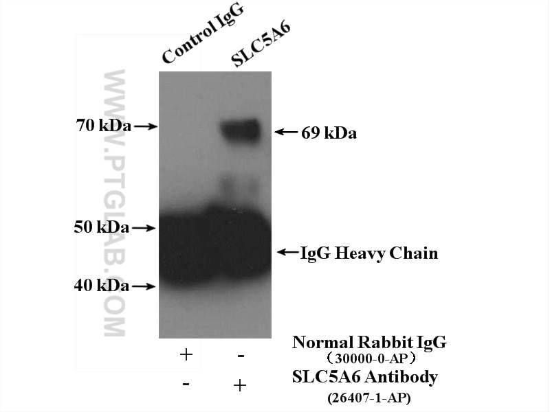 Immunoprecipitation (IP) experiment of mouse brain tissue using SLC5A6 Polyclonal antibody (26407-1-AP)