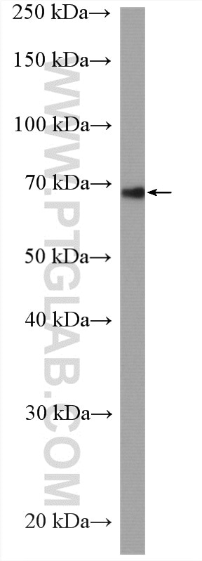 Western Blot (WB) analysis of Caco-2 cells using SLC5A6 Polyclonal antibody (26407-1-AP)