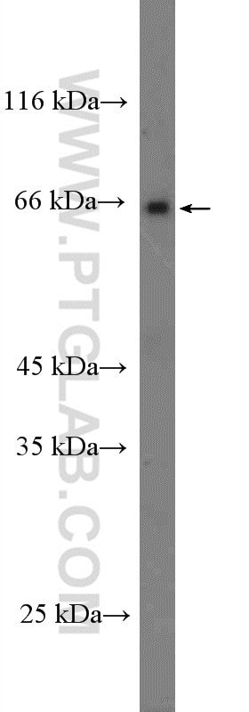 Western Blot (WB) analysis of mouse brain tissue using SLC5A6 Polyclonal antibody (26407-1-AP)