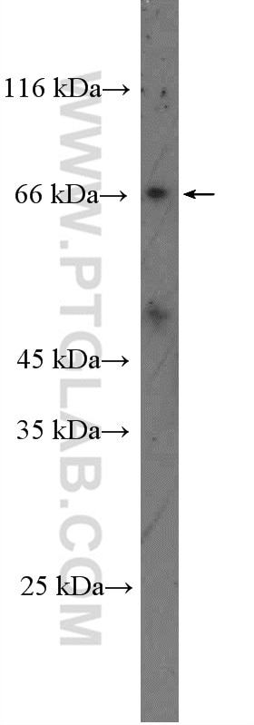 Western Blot (WB) analysis of mouse small intestine tissue using SLC5A6 Polyclonal antibody (26407-1-AP)