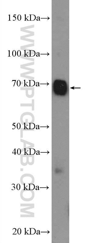 Western Blot (WB) analysis of COLO 320 cells using SLC5A6 Polyclonal antibody (26407-1-AP)