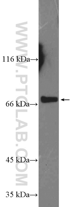 Western Blot (WB) analysis of COLO 320 cells using SLC5A6 Polyclonal antibody (26407-1-AP)