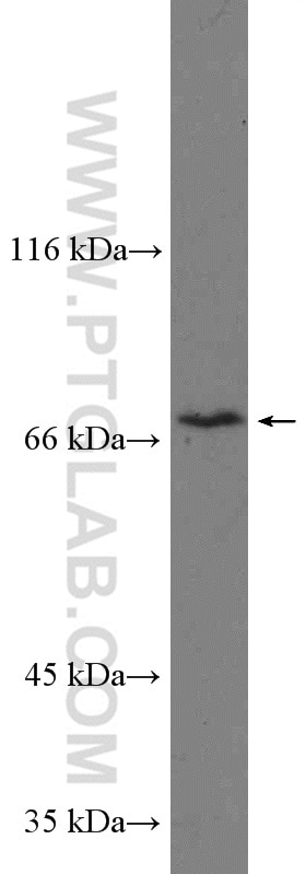 Western Blot (WB) analysis of rat brain tissue using SLC5A6 Polyclonal antibody (26407-1-AP)