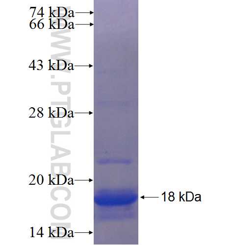 SLC5A6 fusion protein Ag23907 SDS-PAGE
