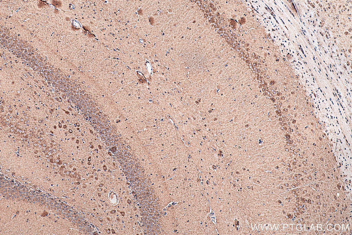 Immunohistochemistry (IHC) staining of rat brain tissue using CHT1 Polyclonal antibody (21848-1-AP)