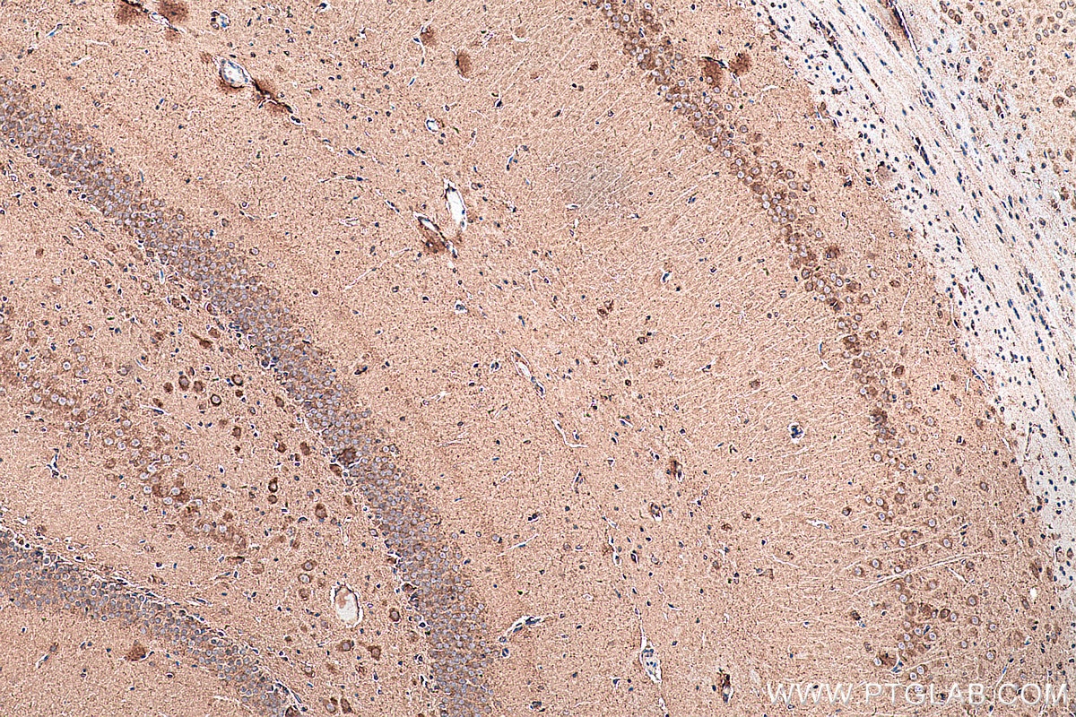 IHC staining of rat brain using 21848-1-AP