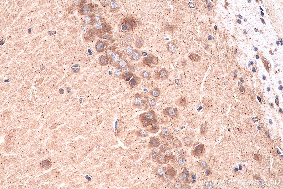 IHC staining of rat brain using 21848-1-AP