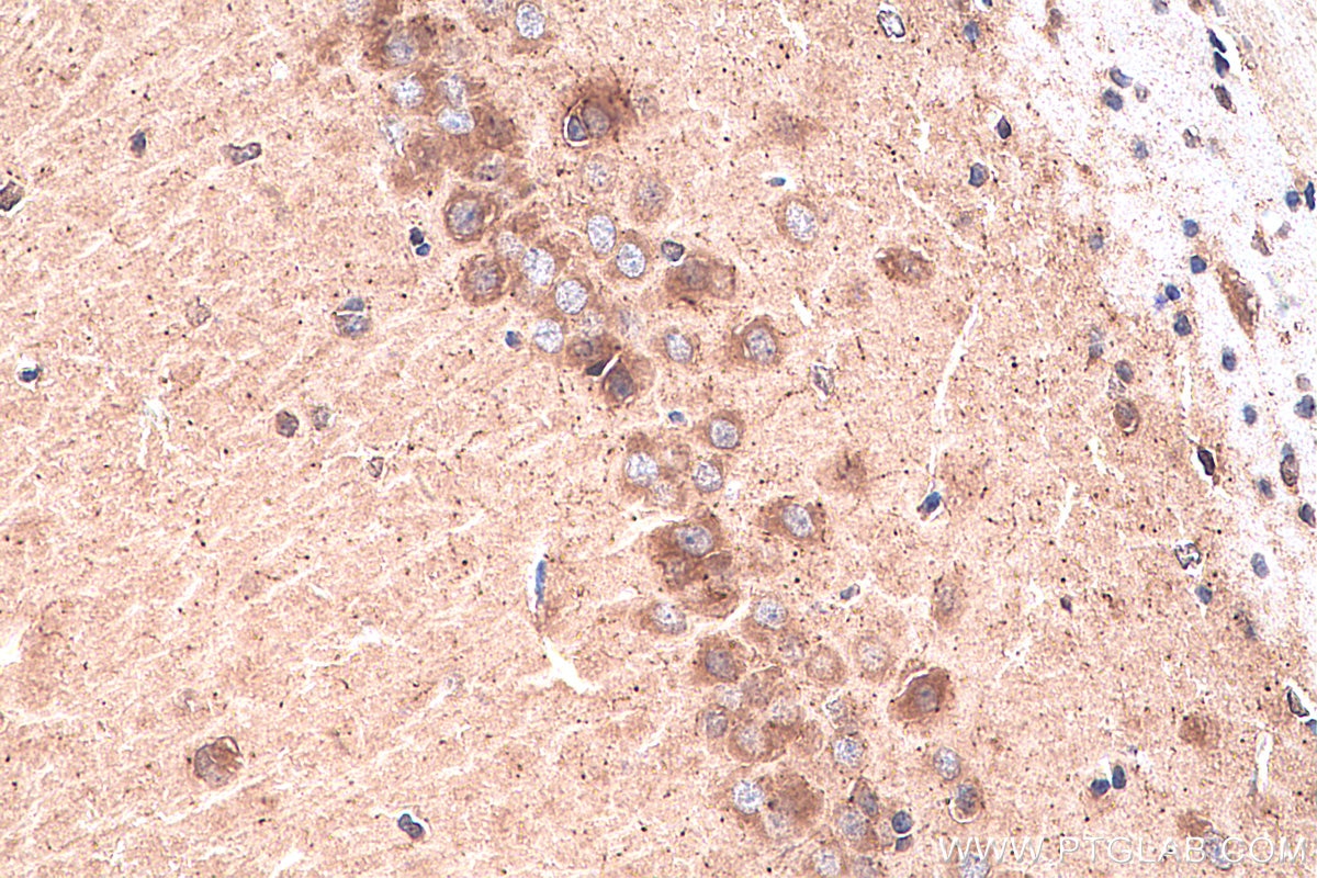 Immunohistochemistry (IHC) staining of rat brain tissue using CHT1 Polyclonal antibody (21848-1-AP)