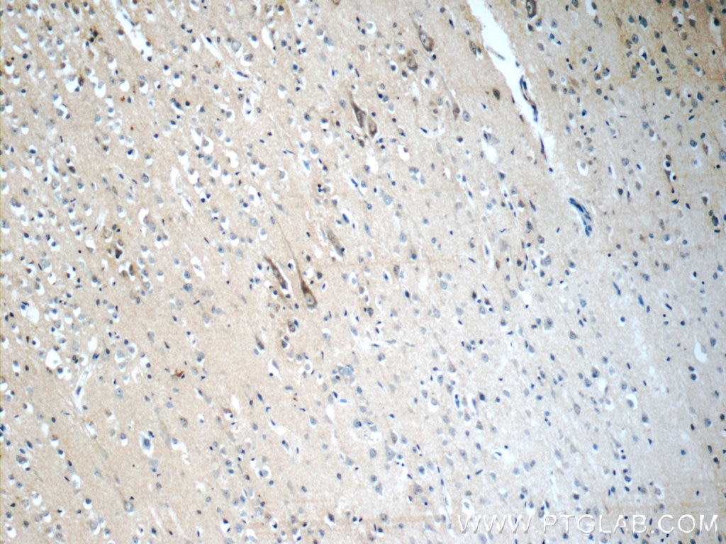 Immunohistochemistry (IHC) staining of human brain tissue using CHT1 Polyclonal antibody (21848-1-AP)