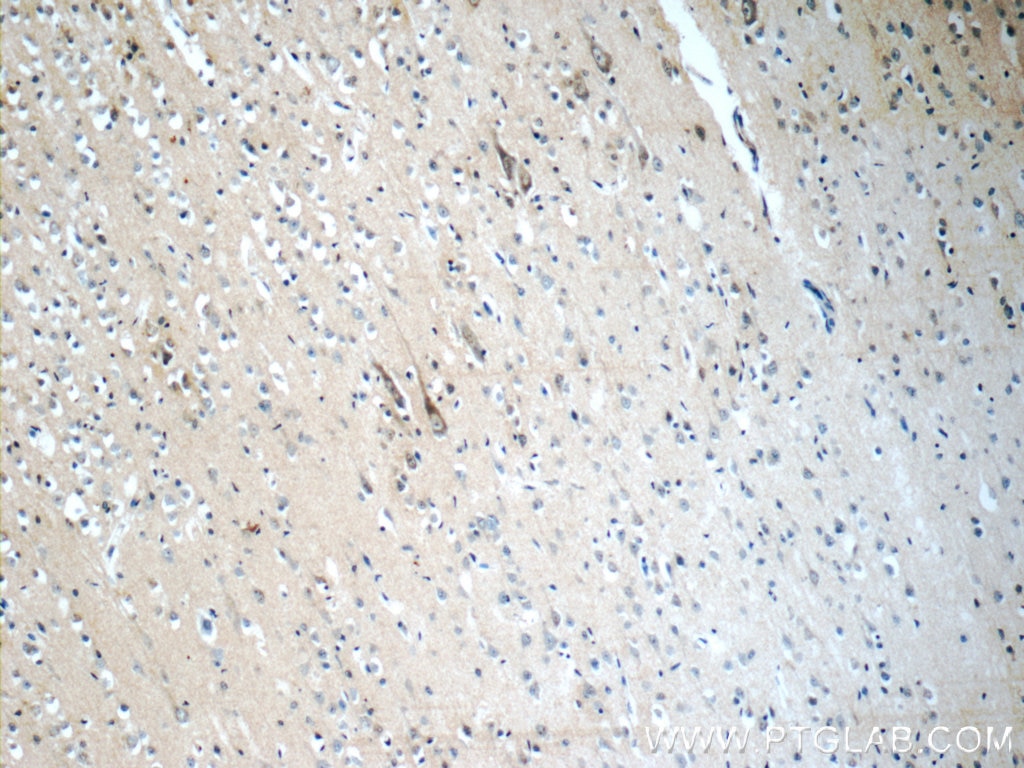 CHT1