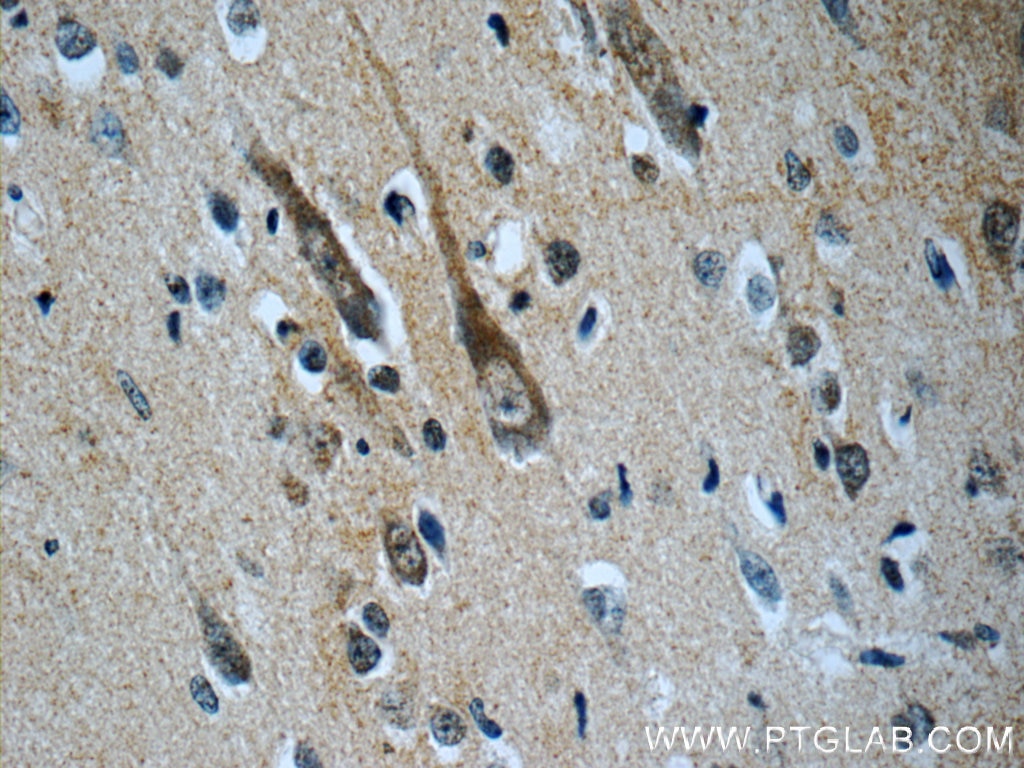 Immunohistochemistry (IHC) staining of human brain tissue using CHT1 Polyclonal antibody (21848-1-AP)