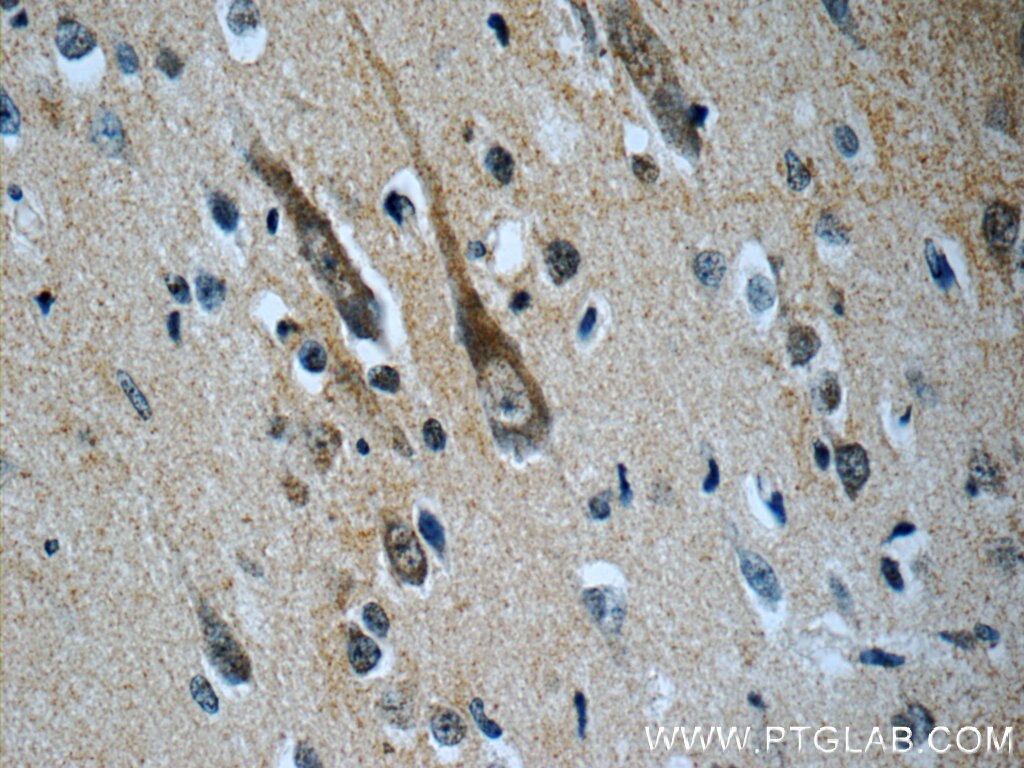 IHC staining of human brain using 21848-1-AP