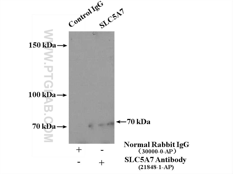 Immunoprecipitation (IP) experiment of mouse heart tissue using CHT1 Polyclonal antibody (21848-1-AP)