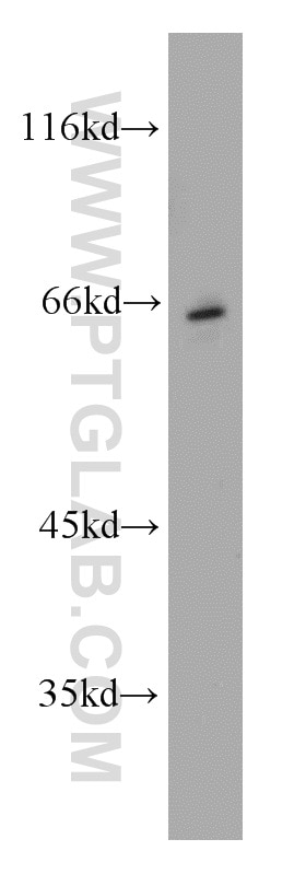 Western Blot (WB) analysis of mouse brain tissue using CHT1 Polyclonal antibody (21848-1-AP)