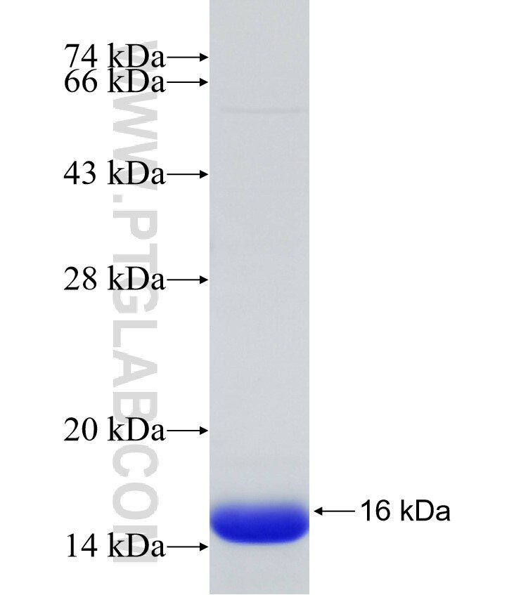 SLC5A7 fusion protein Ag31031 SDS-PAGE SLC5A7 fusion protein Ag31031 SDS-PAGE