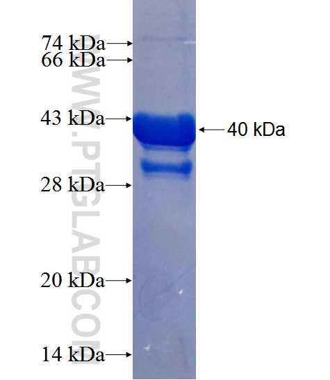 SLC5A7 fusion protein Ag16136 SDS-PAGE
