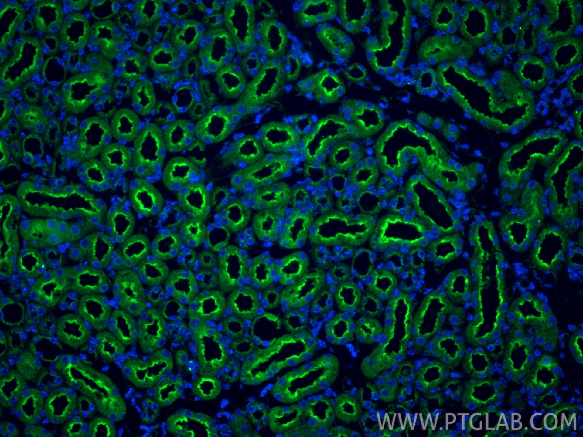 Immunofluorescence (IF) / fluorescent staining of mouse kidney tissue using SLC5A8 Polyclonal antibody (21433-1-AP)