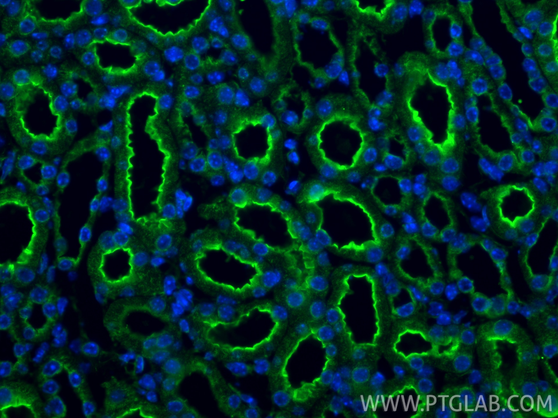 Immunofluorescence (IF) / fluorescent staining of mouse kidney tissue using SLC5A8 Polyclonal antibody (21433-1-AP)