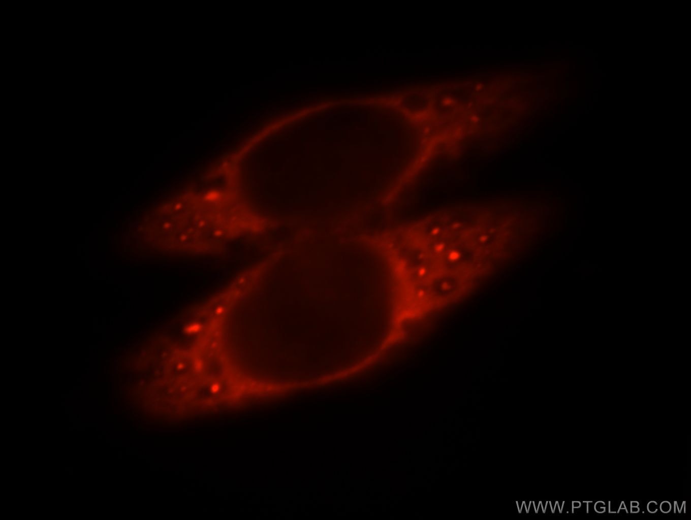 Immunofluorescence (IF) / fluorescent staining of HeLa cells using SLC5A8 Polyclonal antibody (21433-1-AP)