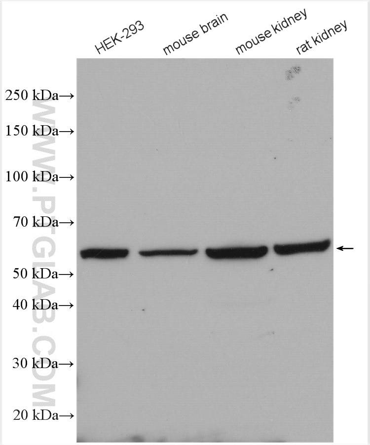Western Blot (WB) analysis of various lysates using SLC5A8 Polyclonal antibody (21433-1-AP)