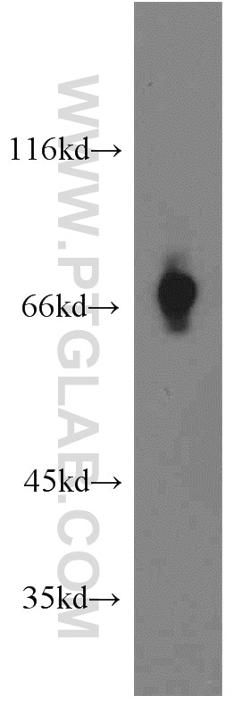 Western Blot (WB) analysis of human brain tissue using SLC5A8 Polyclonal antibody (21433-1-AP)