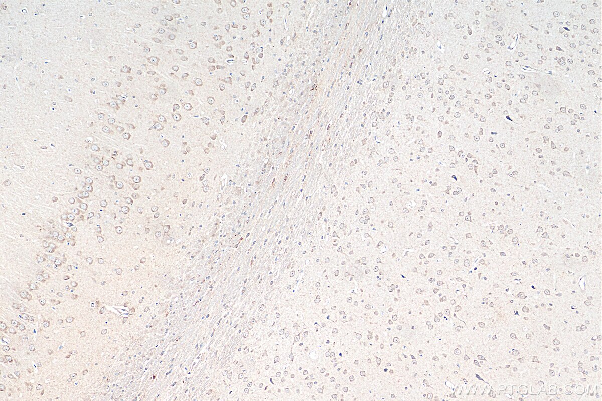 Immunohistochemistry (IHC) staining of rat brain tissue using SLC5A8 Polyclonal antibody (29827-1-AP)