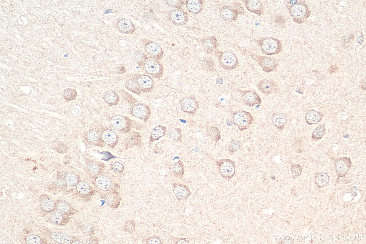 Immunohistochemistry (IHC) staining of rat brain tissue using SLC5A8 Polyclonal antibody (29827-1-AP)