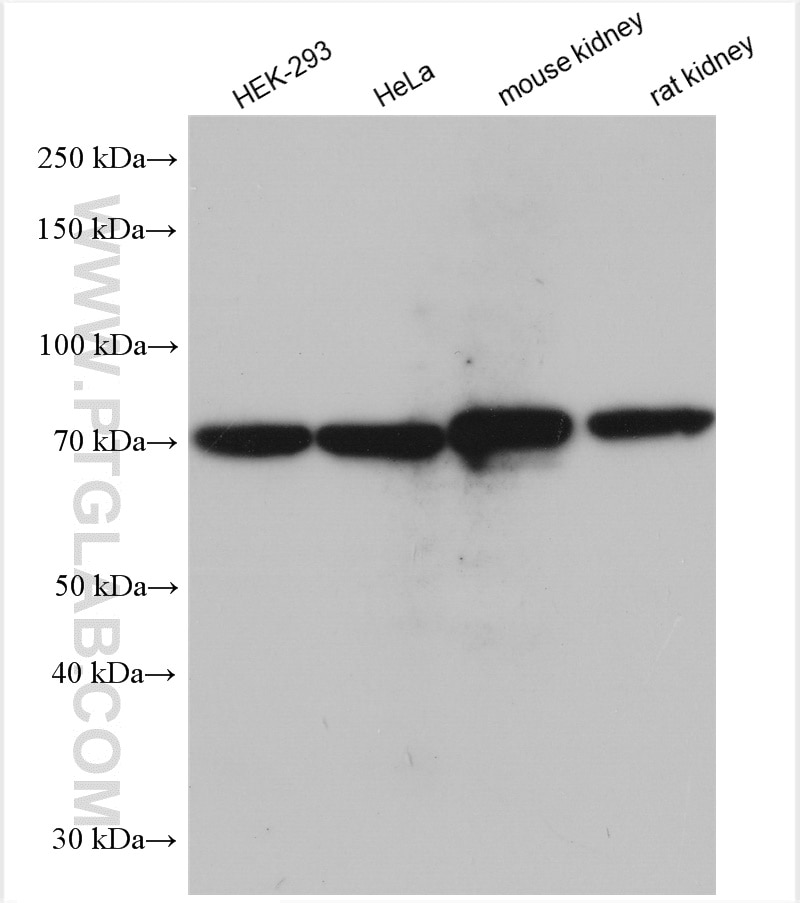 Western Blot (WB) analysis of various lysates using SLC5A8 Polyclonal antibody (29827-1-AP)