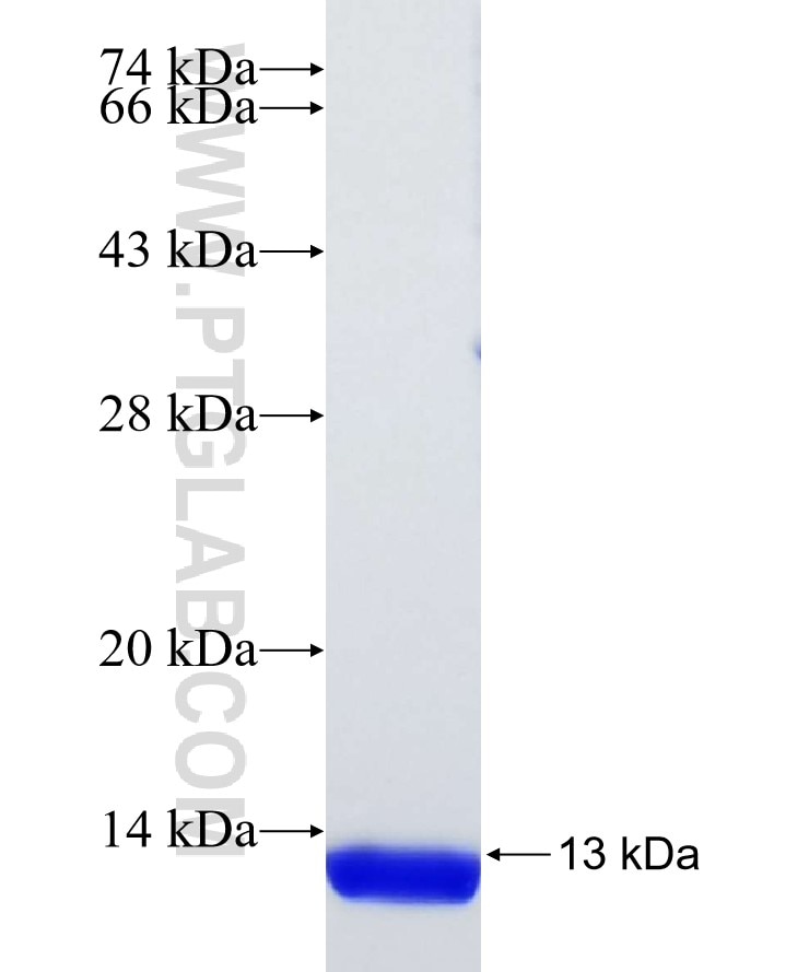 SLC5A8 fusion protein Ag30195 SDS-PAGE SLC5A8 fusion protein Ag30195 SDS-PAGE