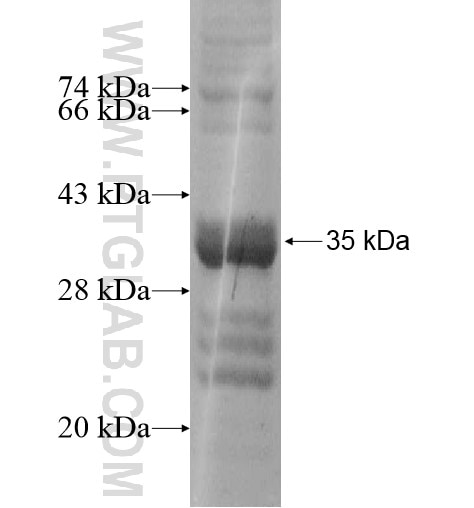 SLC5A8 fusion protein Ag16041 SDS-PAGE