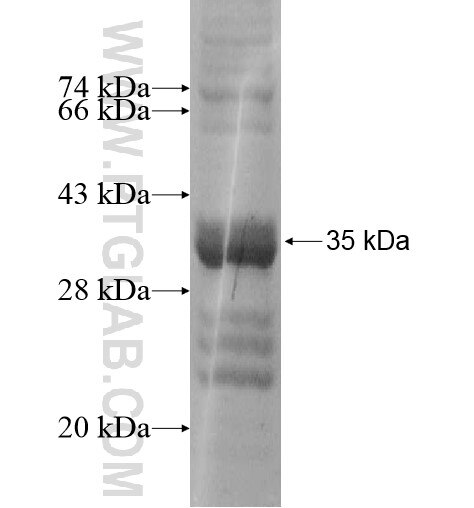 SLC5A8 fusion protein Ag16041 SDS-PAGE