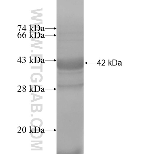 SLC5A9 fusion protein Ag13620 SDS-PAGE
