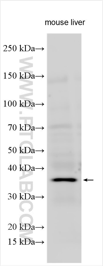 WB analysis using 32069-1-AP (same clone as 32069-1-PBS) Western Blot (WB) analysis of various lysates using SLC66A2 Polyclonal antibody (32069-1-AP)