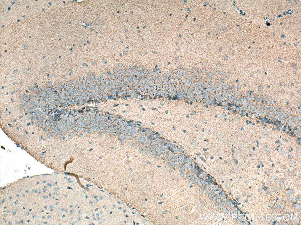 Immunohistochemistry (IHC) staining of mouse brain tissue using GAT1 Polyclonal antibody (28488-1-AP)