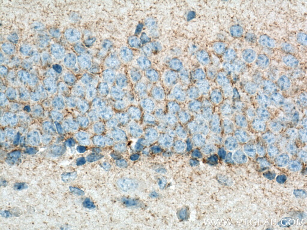 Immunohistochemistry (IHC) staining of mouse brain tissue using GAT1 Polyclonal antibody (28488-1-AP)