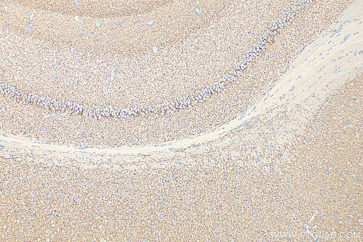 Immunohistochemistry (IHC) staining of mouse brain tissue using GAT1 Polyclonal antibody (28488-1-AP)