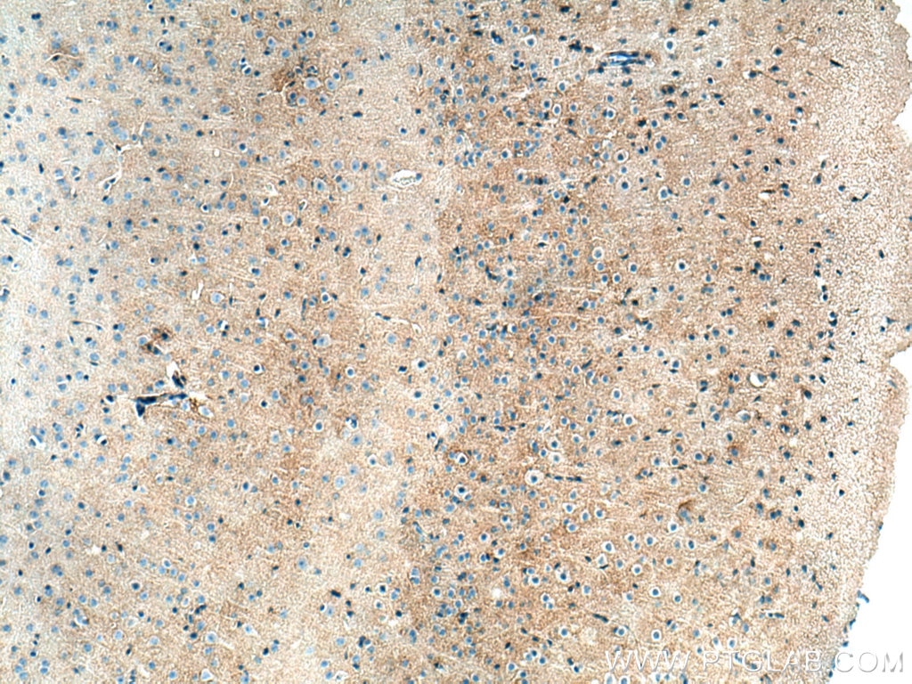 Immunohistochemistry (IHC) staining of mouse brain tissue using SLC6A11 Polyclonal antibody (13920-1-AP)
