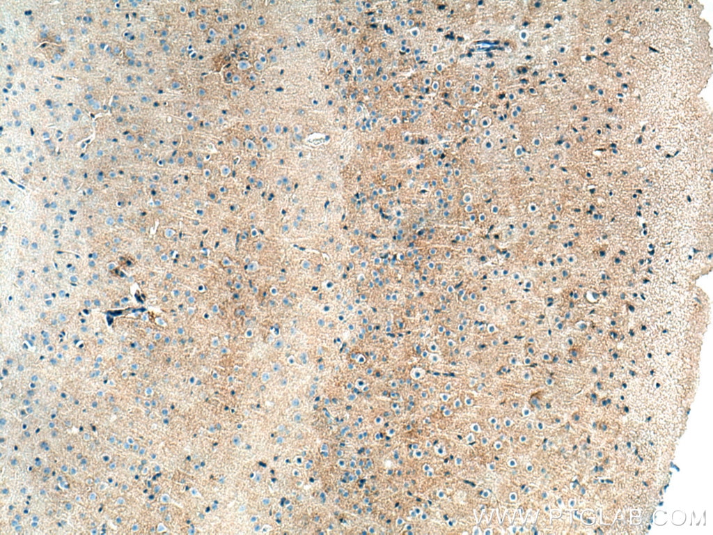 Immunohistochemistry (IHC) staining of mouse brain tissue using SLC6A11 Polyclonal antibody (13920-1-AP)