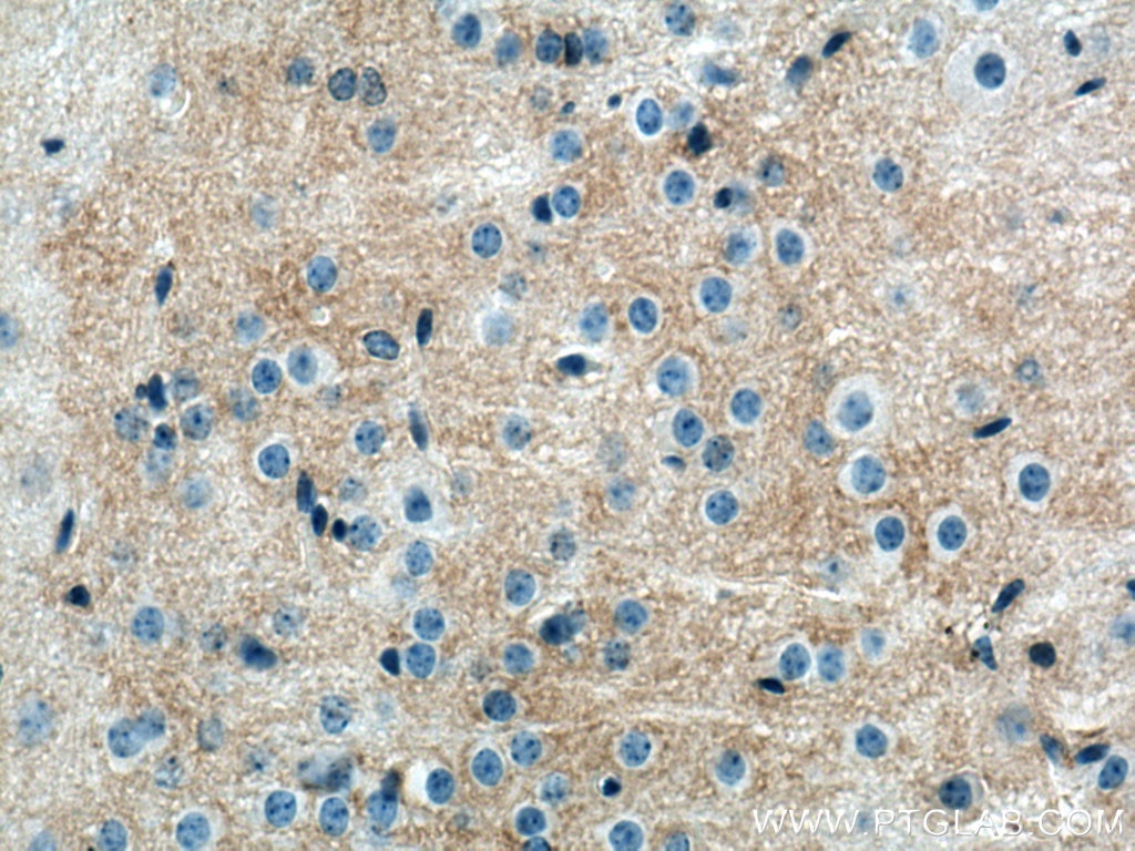 Immunohistochemistry (IHC) staining of mouse brain tissue using SLC6A11 Polyclonal antibody (13920-1-AP)