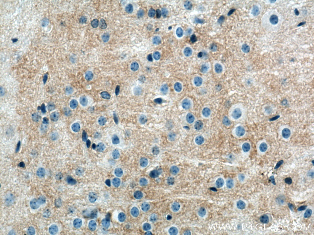 IHC staining of mouse brain using 13920-1-AP